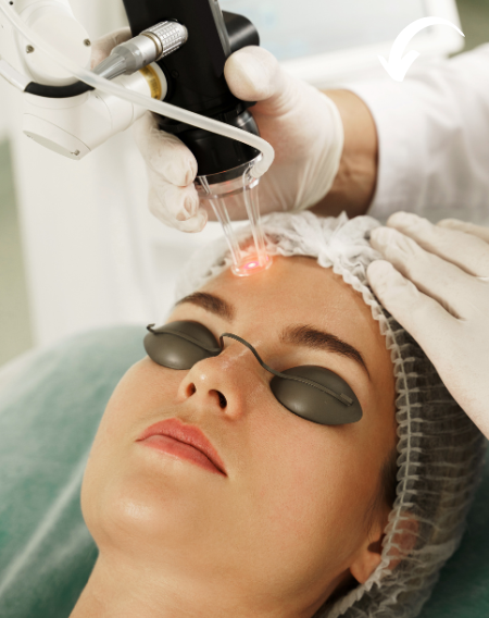 co2 laser resurfacing dr nitin verma skin specialist medi skin laser clinic 